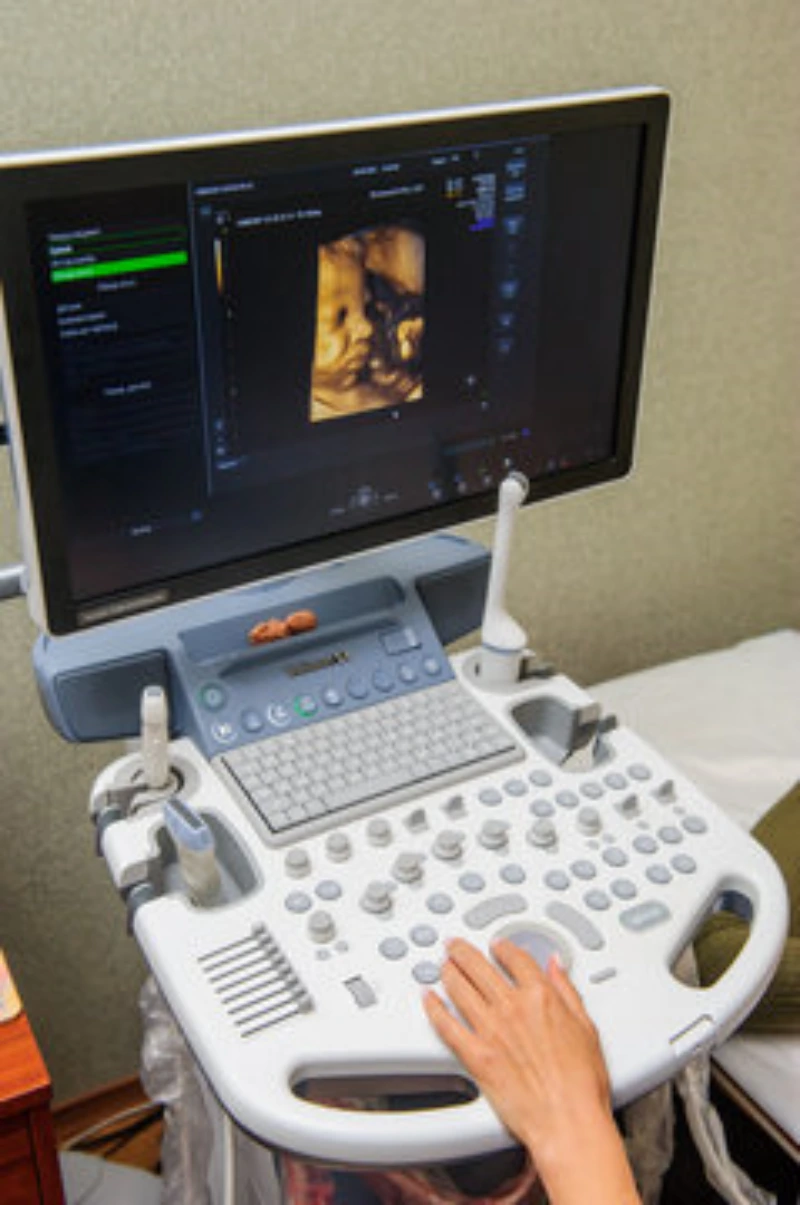 Locação de ultrassom color doppler