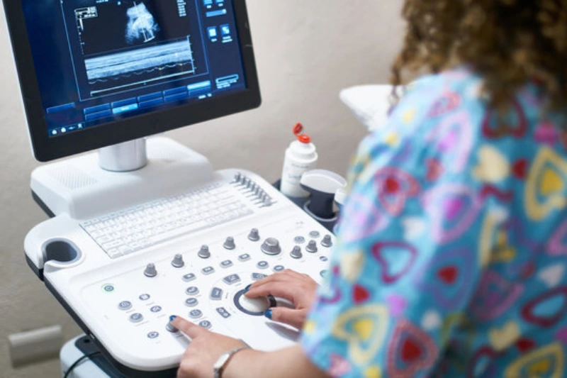 Reparo de ultrassom color doppler